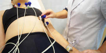 Cooperativa varejista disponibiliza exame de eletrocardiograma gratuito para a comunidade